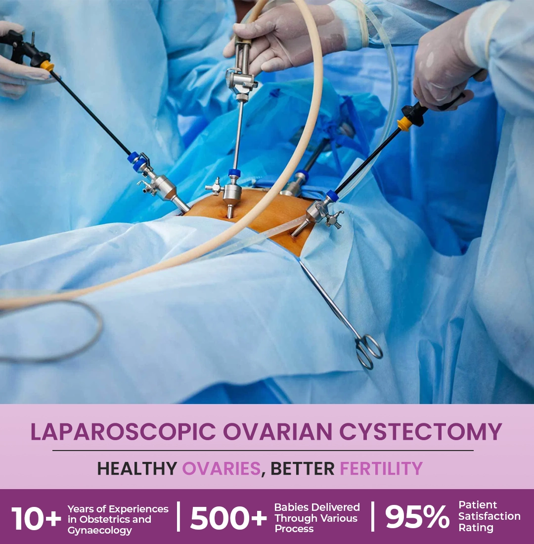 Laparoscopic Ovarian Cystectomy